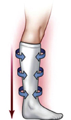Compression Stockings