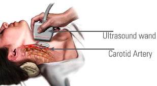 Carotid Artery Disease is diagnosed