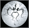 Arteriogram