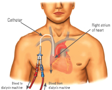 Vascular Access